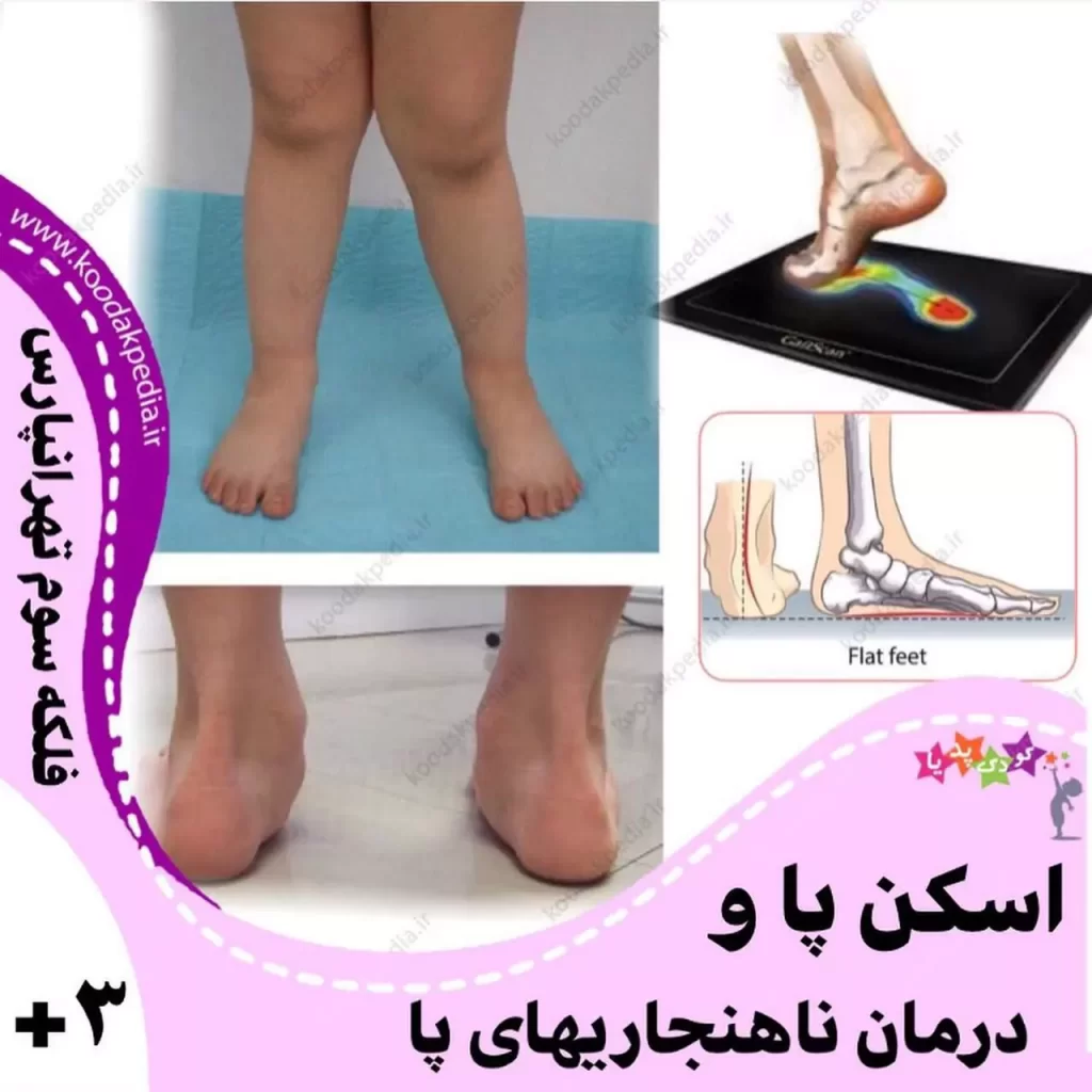 همه خدمات برای سنین ۳سال به بالا می باشد. . بی شک یکی از مهم ترین اعضاحرکتی و تحمل وزن بدن کودک و نوجوان، پا می باشد و وجود عارضه در این عضو می تواند باعث اختلال در حرکت کودک و بروز خستگی زودرس افراد شود.